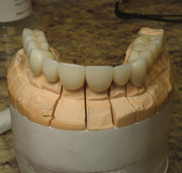 tooth model