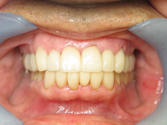 teeth