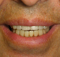 smiling North Shore Dental patient