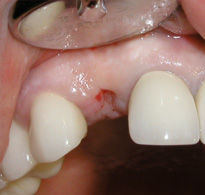 Smile Gallery image