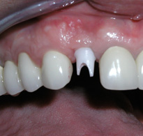 Smile Gallery image