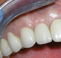 Smile Gallery image