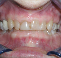 Smile Gallery image