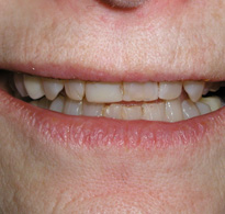 Smile Gallery image