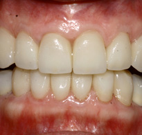 Smile Gallery image