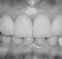 Smile Gallery image
