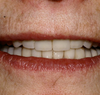 Smile Gallery image
