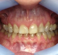 Smile Gallery image