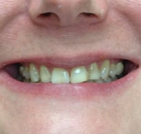 Smile Gallery image