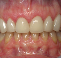 Smile Gallery image