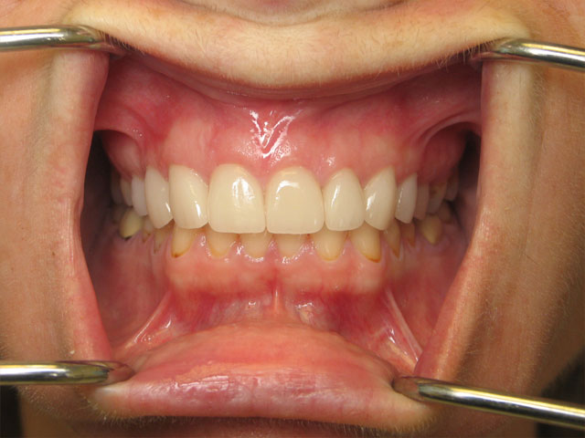 Smile Gallery image