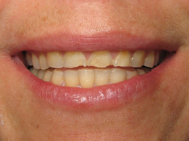 Smile Gallery image