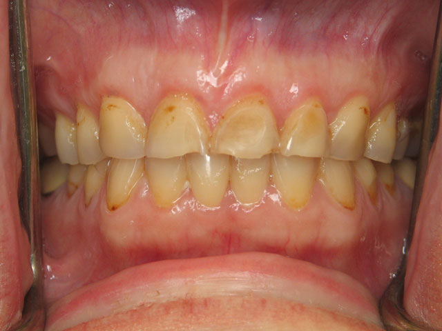 Smile Gallery image