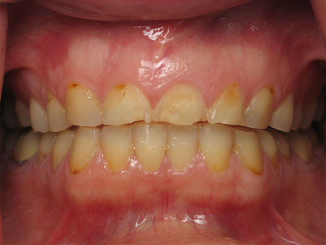 Smile Gallery image