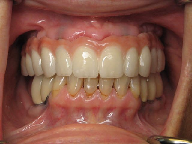 Smile Gallery image