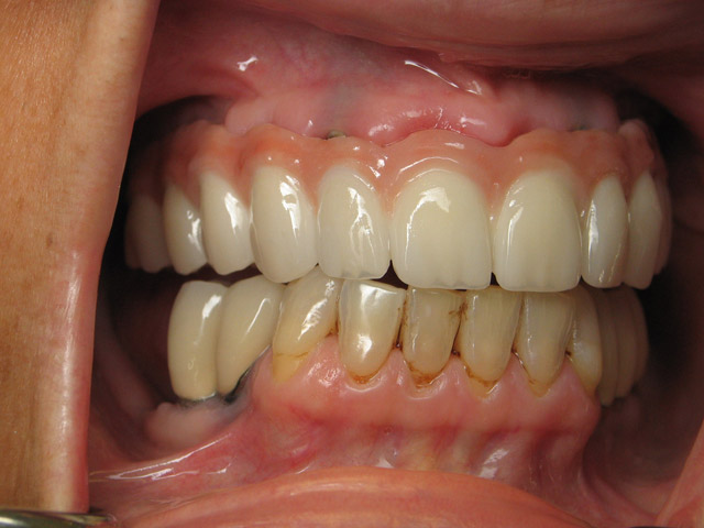 Smile Gallery image