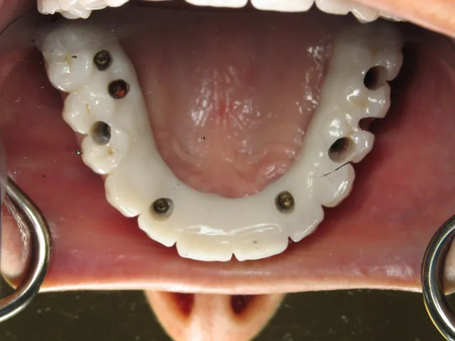 Smile Gallery image