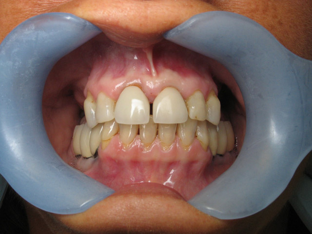 Smile Gallery image