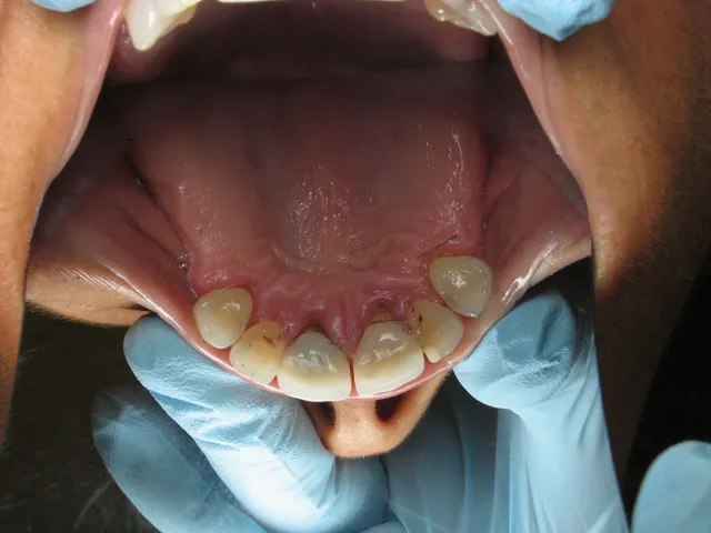Smile Gallery image