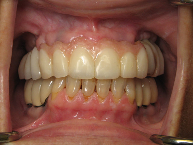 Smile Gallery image