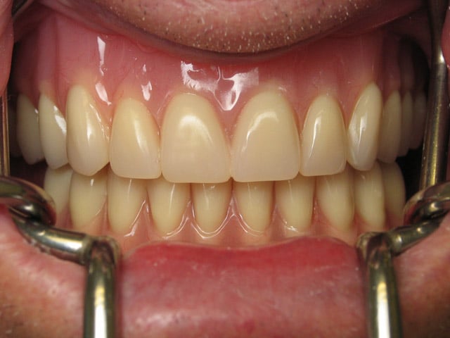 Smile Gallery image