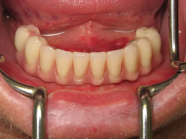 Smile Gallery image