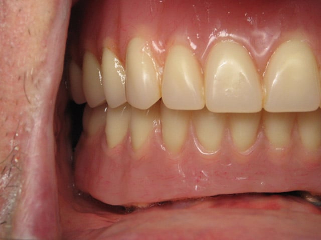 Smile Gallery image