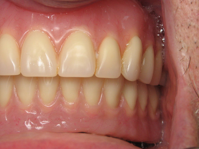 Smile Gallery image