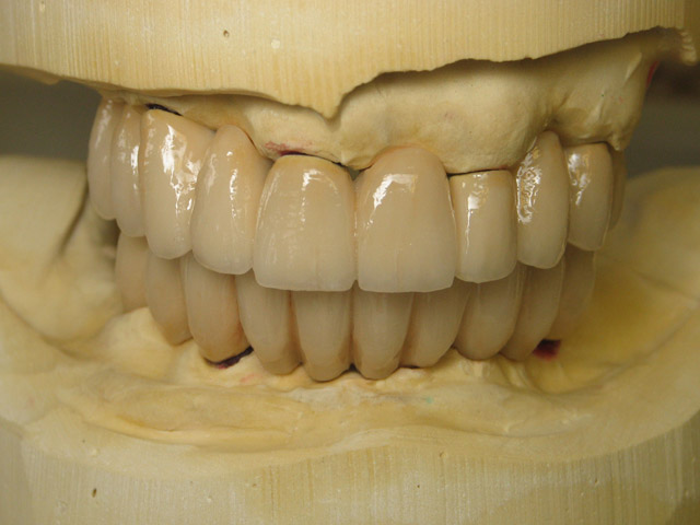 Smile Gallery image