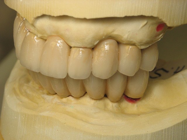 Smile Gallery image