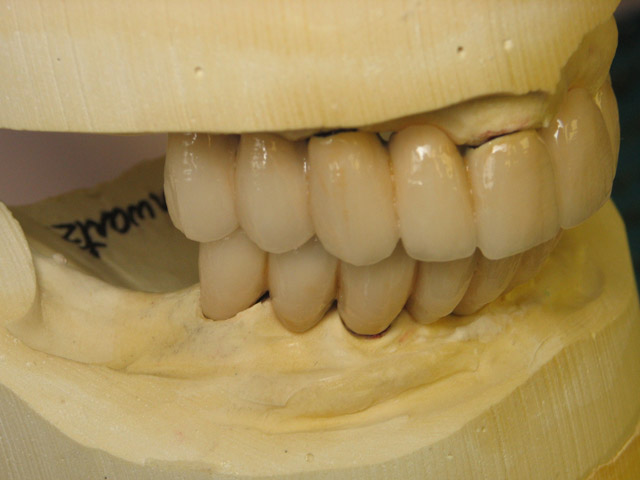 Smile Gallery image