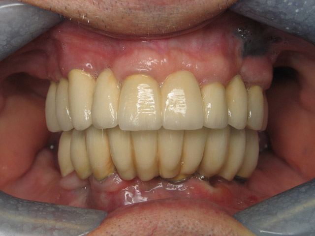 Smile Gallery image