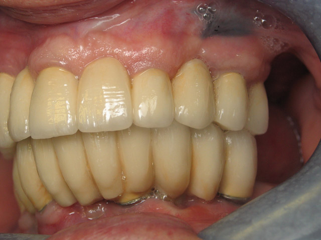 Smile Gallery image