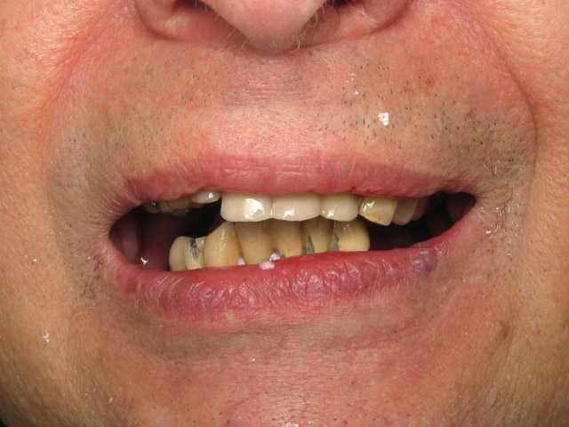Smile Gallery image