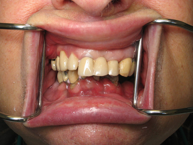 Smile Gallery image