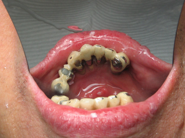 Smile Gallery image