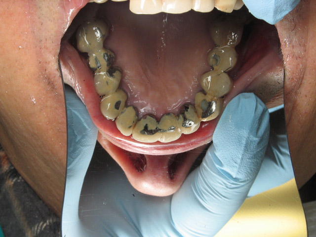 Smile Gallery image