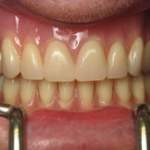 North Shore Dental, smile close-up