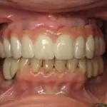 smile close-up, Northshore Dental