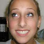 North Shore Dental smiling patient