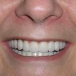 North Shore Dental, new smile