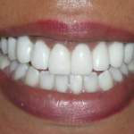 new smile, North Shore Dental
