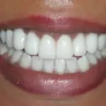 new smile, North Shore Dental