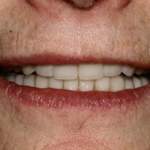 North Shore Dental, smile post-treatment