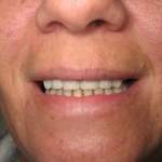 Dr. Gardner, patient with new smile