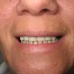 Dr. Gardner, patient with new smile