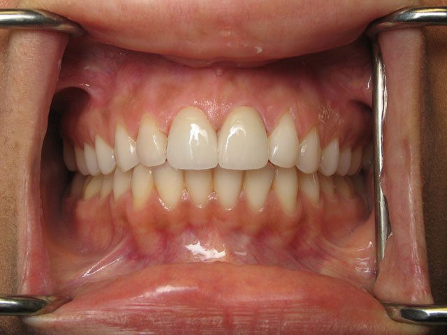 Smile Gallery image
