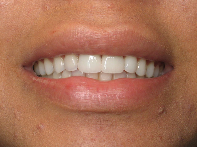 Smile Gallery image
