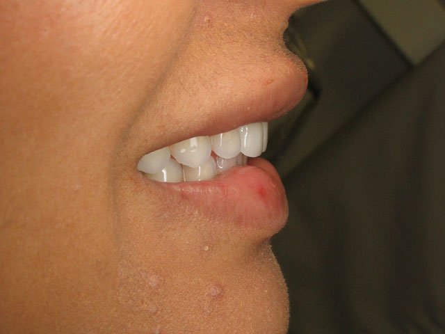 Smile Gallery image