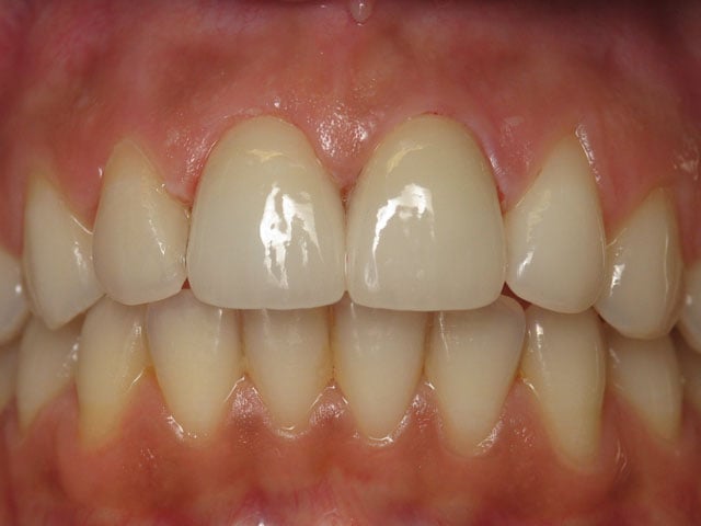 Smile Gallery image